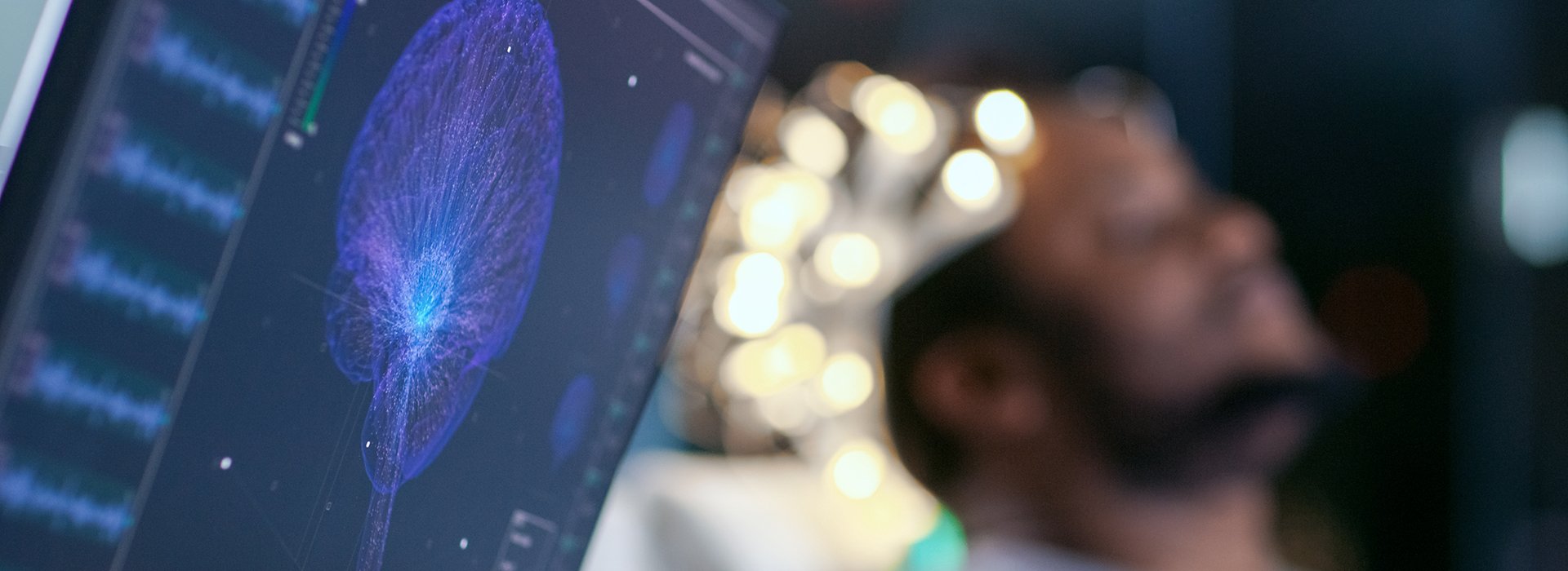 Man laying down with brain scan on computer.