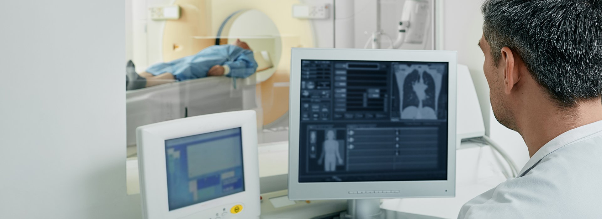 Lung cancer screening